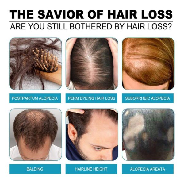 Hair Serum for Growth and Thickness - Image 9