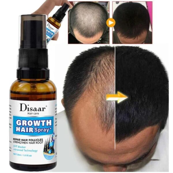 Hair Serum for Growth and Thickness - Image 3