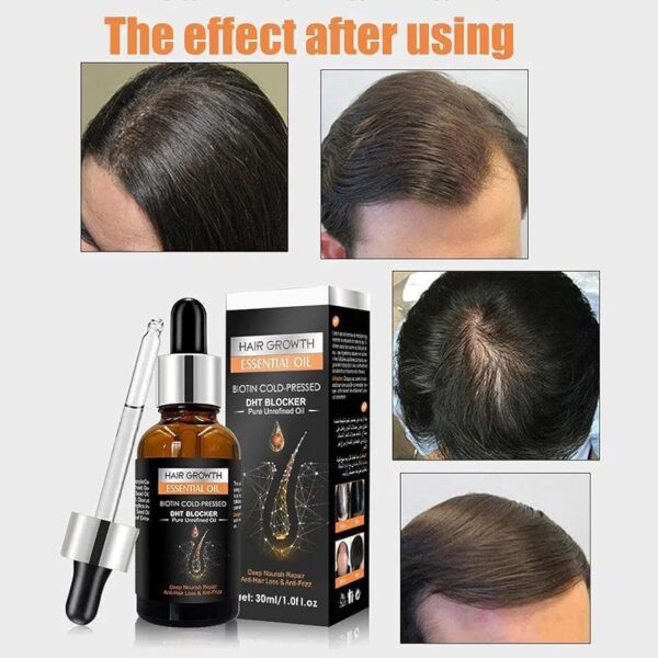 Hair Growth Care Set - Image 4